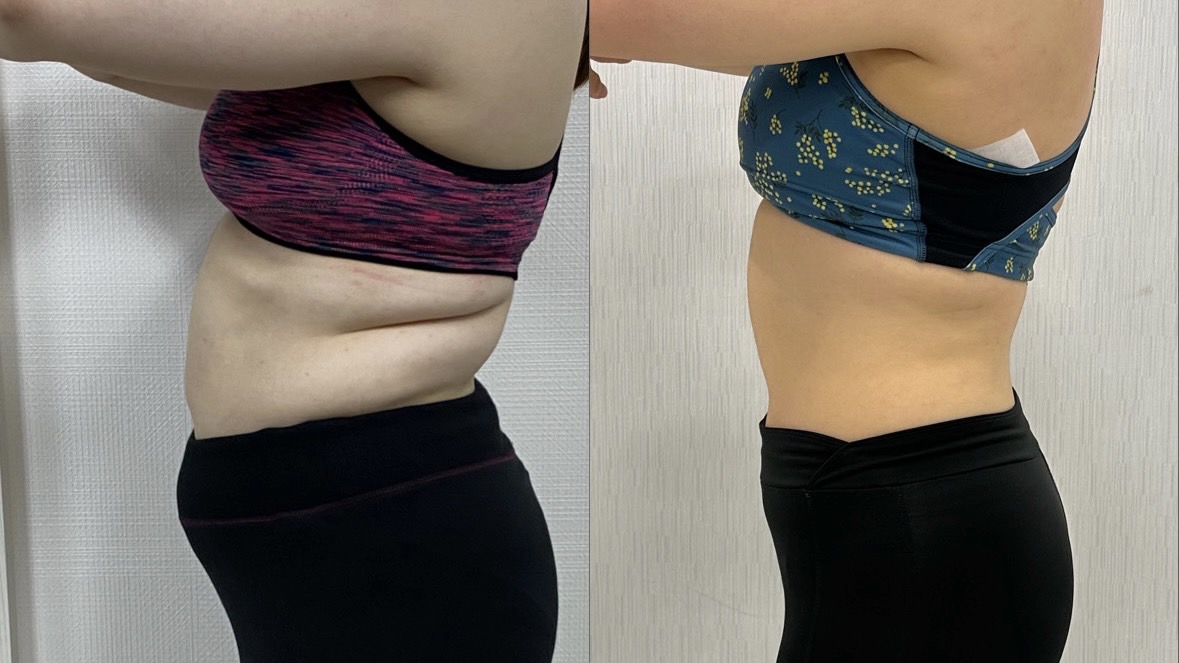 鹿児島市 パーソナルジム 無料体験 ビフォーアフター 1年で-18kg達成！ Aさん様